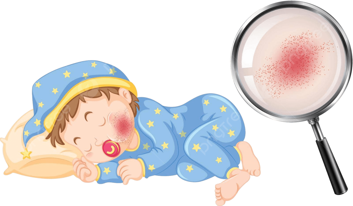 Cách phòng bệnh sởi ở trường học, nhà trẻ